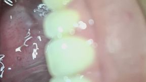 “Sounds of My Gargling”