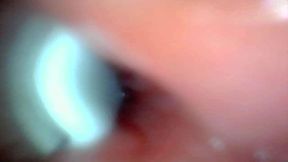 Endoscope Camera Captures Moment of Male Ejaculation 4K