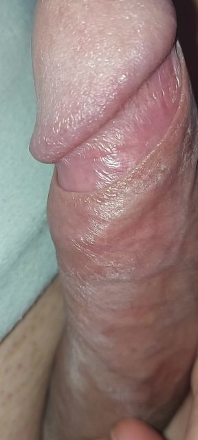 Hardening