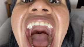 Open mouth