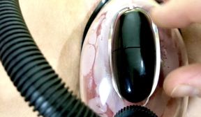 Vaginal Deformation Under the Influence of a Vacuum Pump