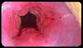 Japanese Mom's Extreme Uterus Filling: Big Objects Insertion & Cervix Dilation