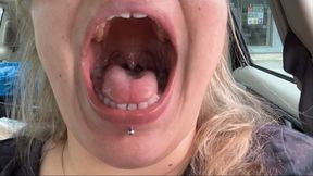 Post Dentist Mouth Tour with Novocaine 720p wmv