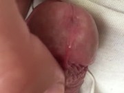 close up head massage "frenulum froid"