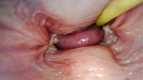 AMAZING INTERNAL POV  CAMERA INSIDE HER PUSSY WHILE I FILL HER WITH CUM