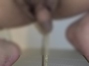 包茎がおしっこした後に皮を剥いた