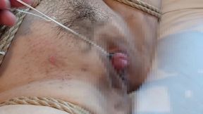 I Aspirate M Woman Clitoris and Am Fixed with Rubber