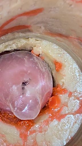 The Camera 4K Inside the Deep Pussy Records a Huge Ejaculation with a Stuck Condom