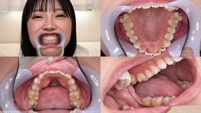 Mio - Watching Inside mouth of Japanese cute girl bite-250-1 - 1080p