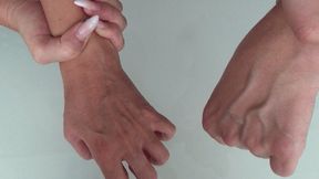 LARGE VEINS ON THE ARMS