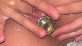 Anal plug