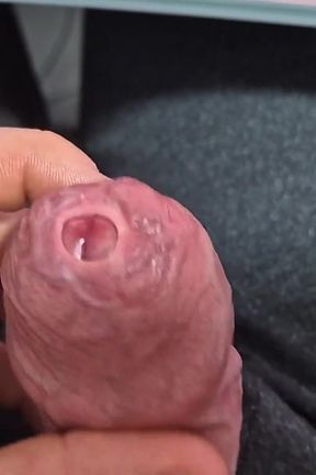 Tight Phimosis Foreskin Stretching with Cumshot!