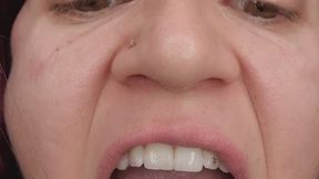 A detailed tour of my mouth