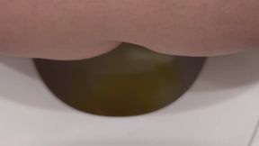 Kennedy Daily Urination