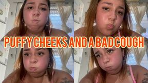 Cough and puffy cheeks