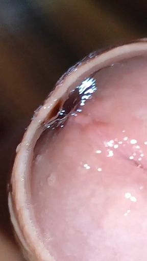 Glans Eye Watering After Intense Fucking.