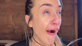 Swollen tonsils irritated by yawning wmv