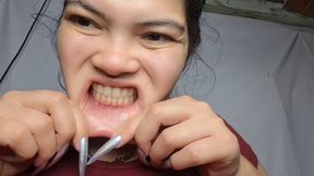 Crazy Stretching of My Lower and Upper Lips