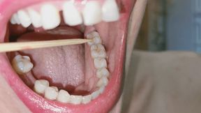 should I find a new dentist-wmv