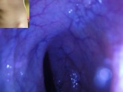 POV - The view staring up my descending colon as I mush you from the outside