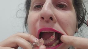 Retainers Fetish Close-Up – Putting In Upper and Lower Retainers, Tongue Play, Talking with Retainers On, Mouth and Teeth Focus Video