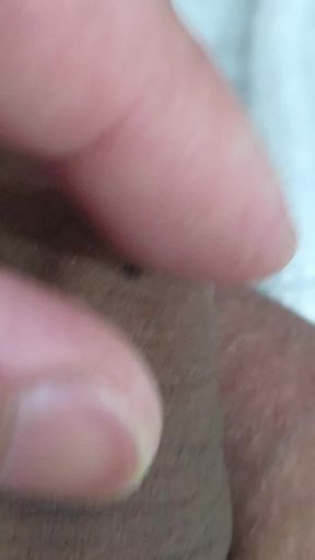 What Is That on My Penis