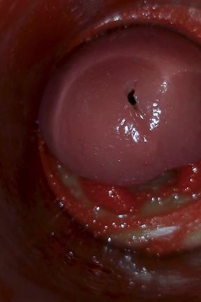 Camera Inside Deep Pussy Captures Huge Ejaculation of Sperm Asmr