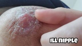 Nipple Skin Peeling Close Up - Detailed Nipple Play