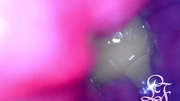 INSIDE ASS POV: The Eggs disappeared in the hole ...