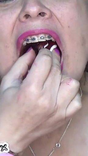 Swallowing Gummy Worms in the Shape of a Knot