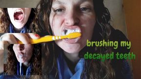 Brushing my decayed teeth