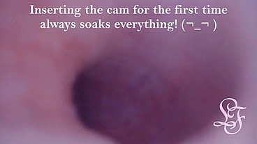 FISRT EVER POV COMSHOT FROM INSIDE THE PROSTATE