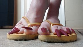 Toenails hanging off yellow flip flops
