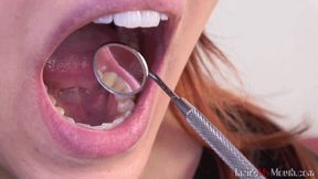 Inside My Mouth - Julie got mouth exam (FullHD)