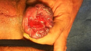 Gaping, pumping and fisting my anal cavity