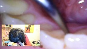 Tech-Savvy Dental Care: A Vore Day Adventure 720HD