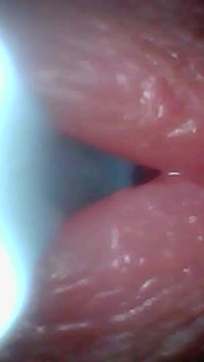 Powerful moment from &quot;Endoscope camera captures moment of male ejaculation&quot;