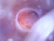 View inside cock while jerking and cumshot ( camera inside dick )