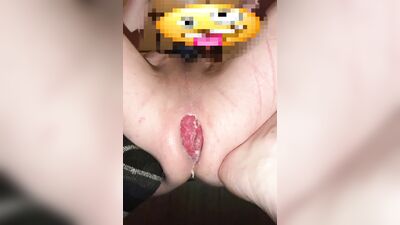 Asshole Stretching to the Max