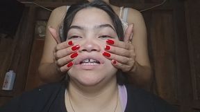 Facial exercises for her distorted face in slow motion