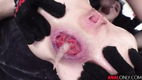 ”Extreme assfucking with Lydia Ebony”