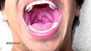 Deep uvula