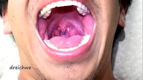 Deep uvula