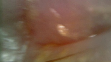 Microscope or endoscope? Sensational farts in a Vore edition inside my ass 4K
