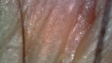 Microscope or endoscope? Sensational farts in a Vore edition inside my ass 4K