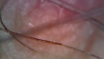 Microscope or endoscope? Sensational farts in a Vore edition inside my ass 4K