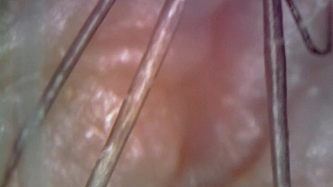 Microscope or endoscope? Sensational farts in a Vore edition inside my ass 4K