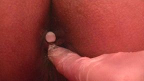 Cutouts: Treatment with laxative suppositories and enemas