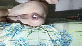 Anal masturbation