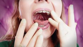 Asmr and Close-ups: Giantess Devour Fetish - Eating Cars From Chocolate. Braces. (arya Grander)